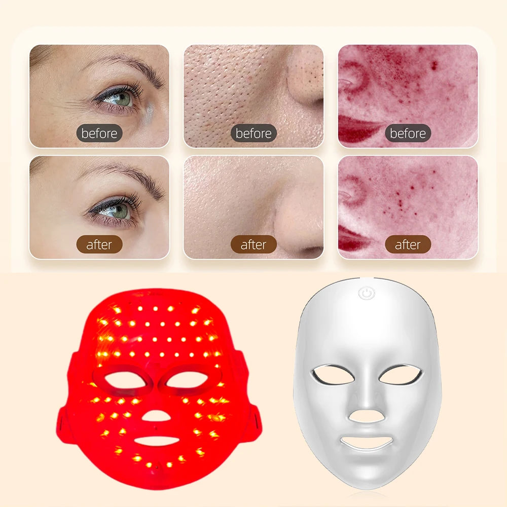 7-Color LED Facial Mask – Skin Rejuvenation & Light Therapy